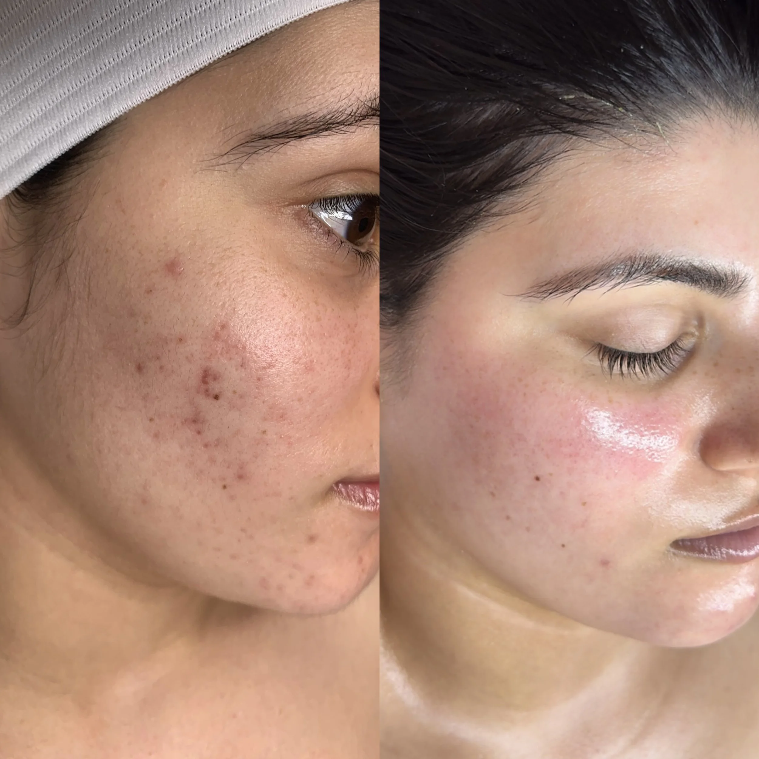 Before _ after dmk.JPG