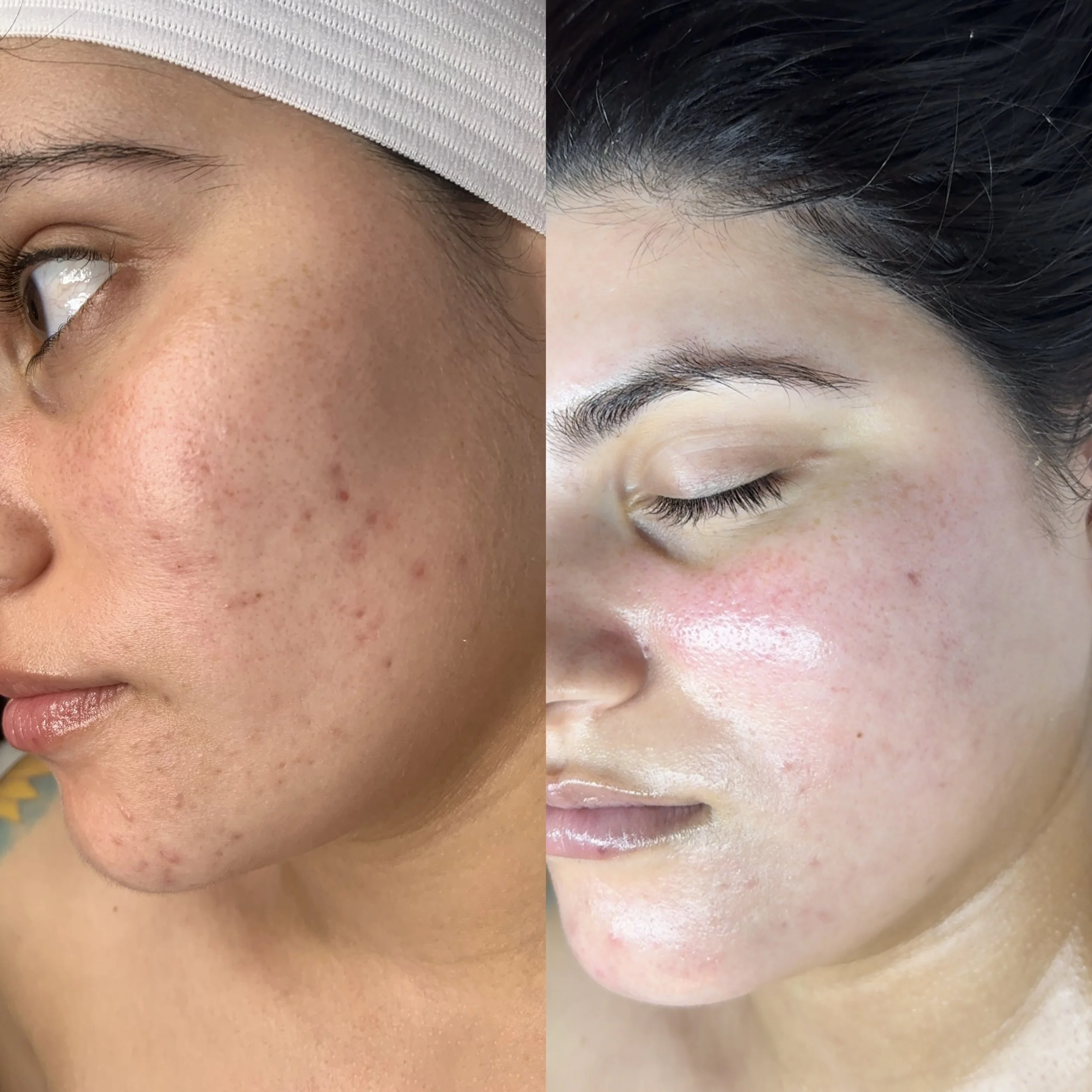 Before _ after dmk .JPG