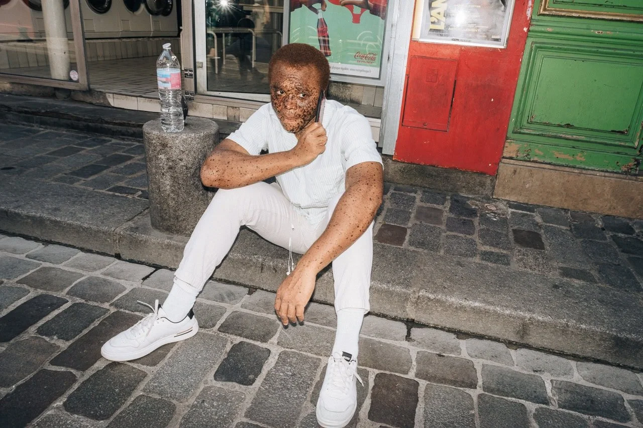 Heavily freckled man sat on the street in Paris
