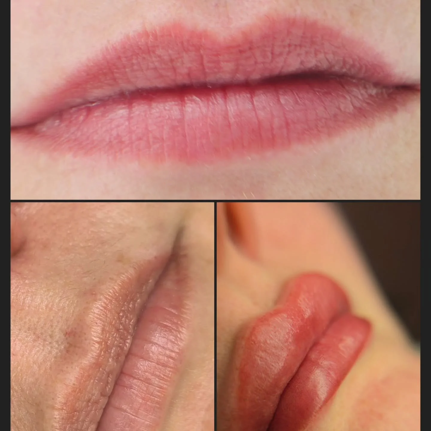 Lip pigmentation ✨
As you can see, the pigment has healed beautifully and the colour is even and natural.
Here is the final result 💋
Subtle enhancement, freshness and elegance.
Hashtags:
#lippigmentation
#lipblush
#pmulips
#permanentmakeuplips
#pmua