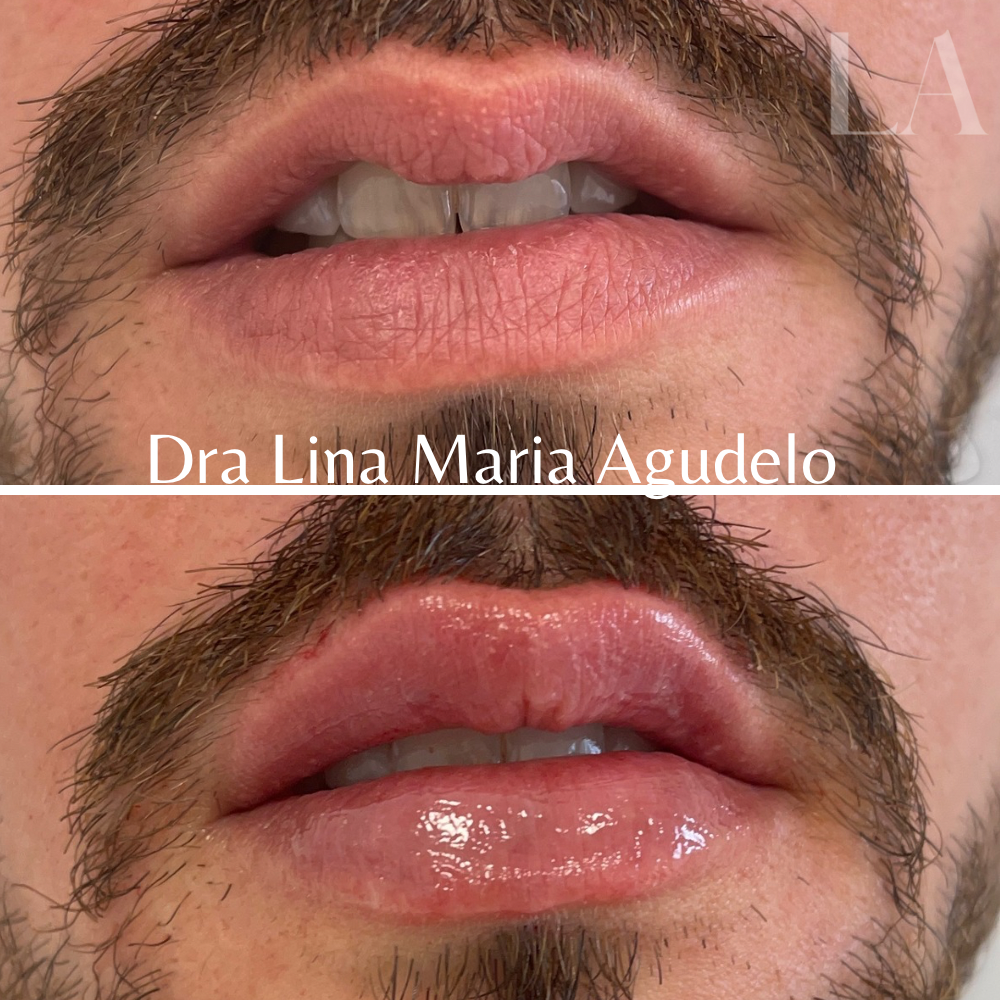 Antes (1000 x 1000 px) - 1 (10).PNG