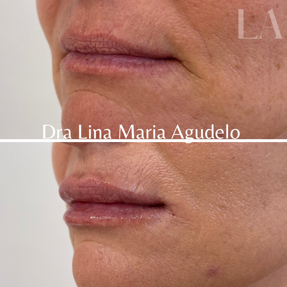 Antes (1000 x 1000 px) - 1 (12).PNG