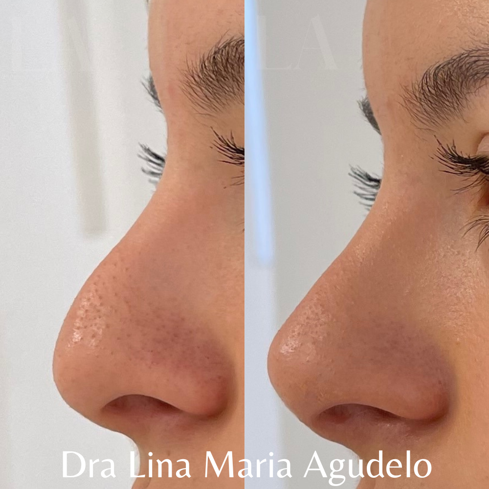 RINOMODELACION 2.png