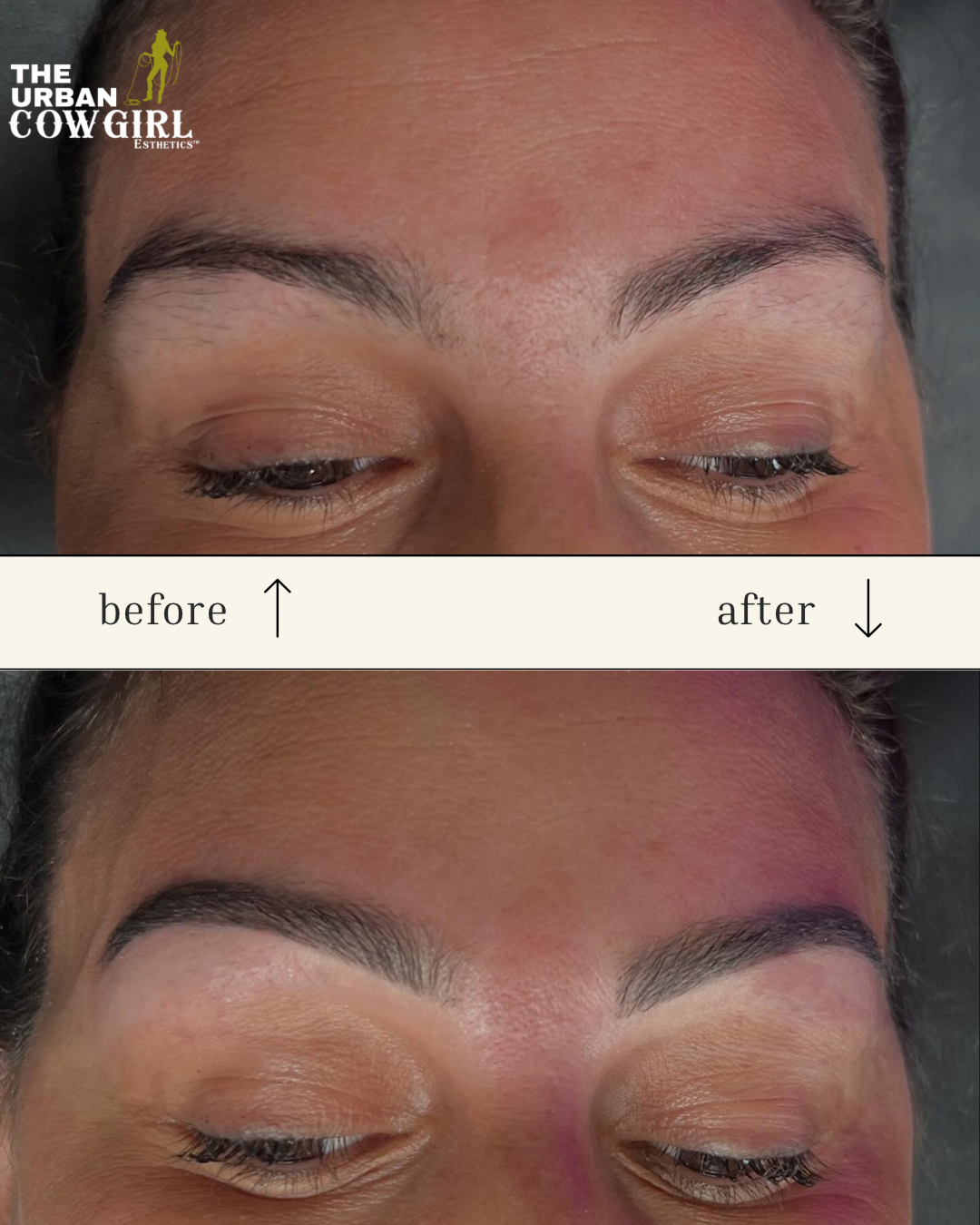 Close-up of a woman's eyebrows before and after a cosmetic eyebrow enhancement procedure, with the 'before' showing less defined brows and the 'after' showing more shaped, fuller eyebrows.