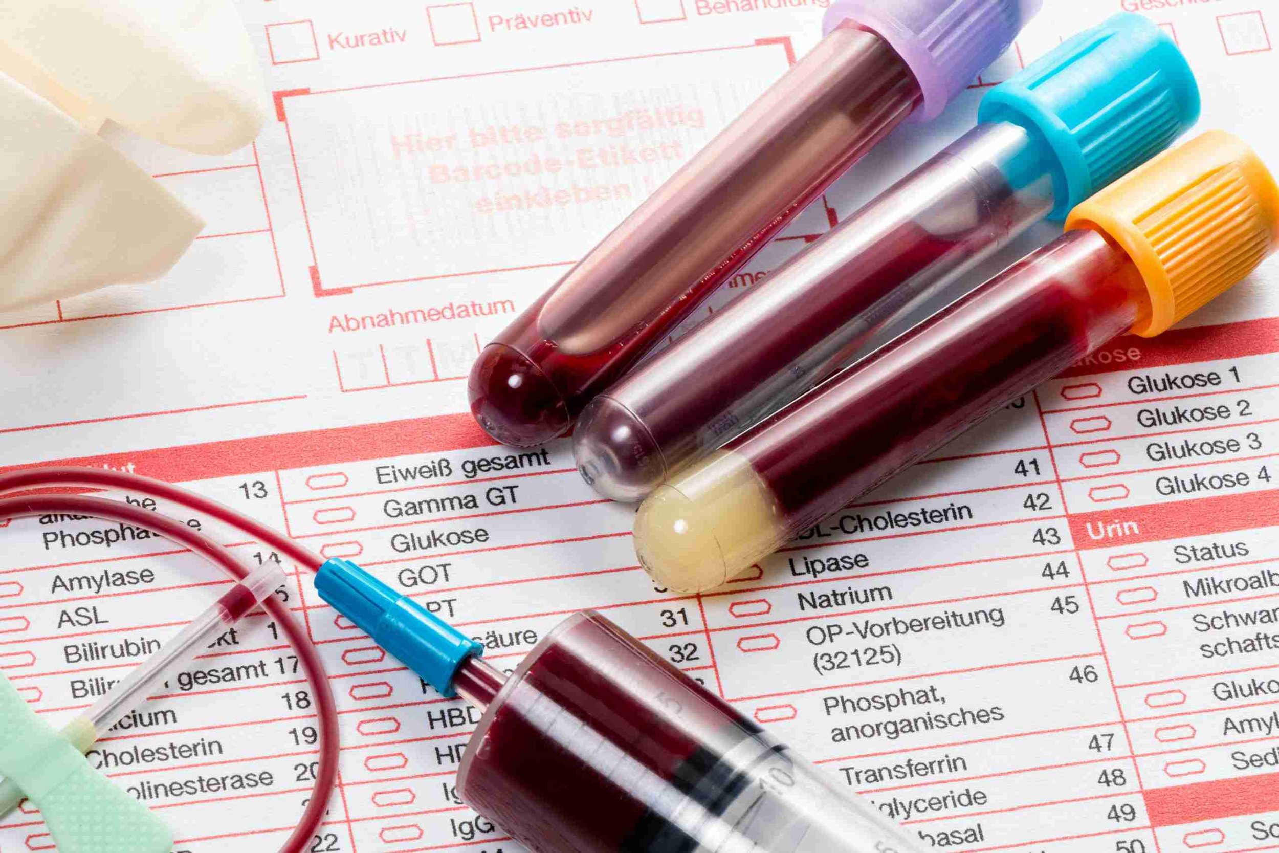 Create your own Blood tests