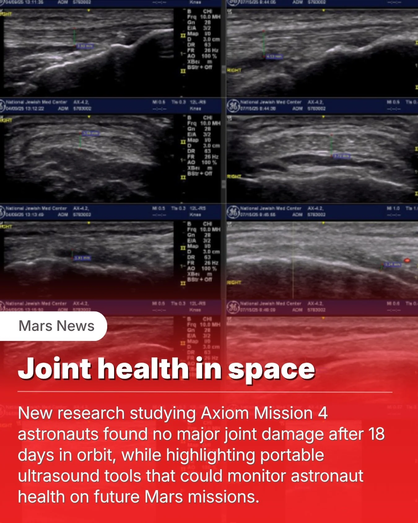 One of the biggest questions about Mars isn&rsquo;t whether humans can get there.

It&rsquo;s what the journey will do to the human body.

New research from National Jewish Health examined astronauts from Axiom Mission 4 after 18 days in orbit and fo