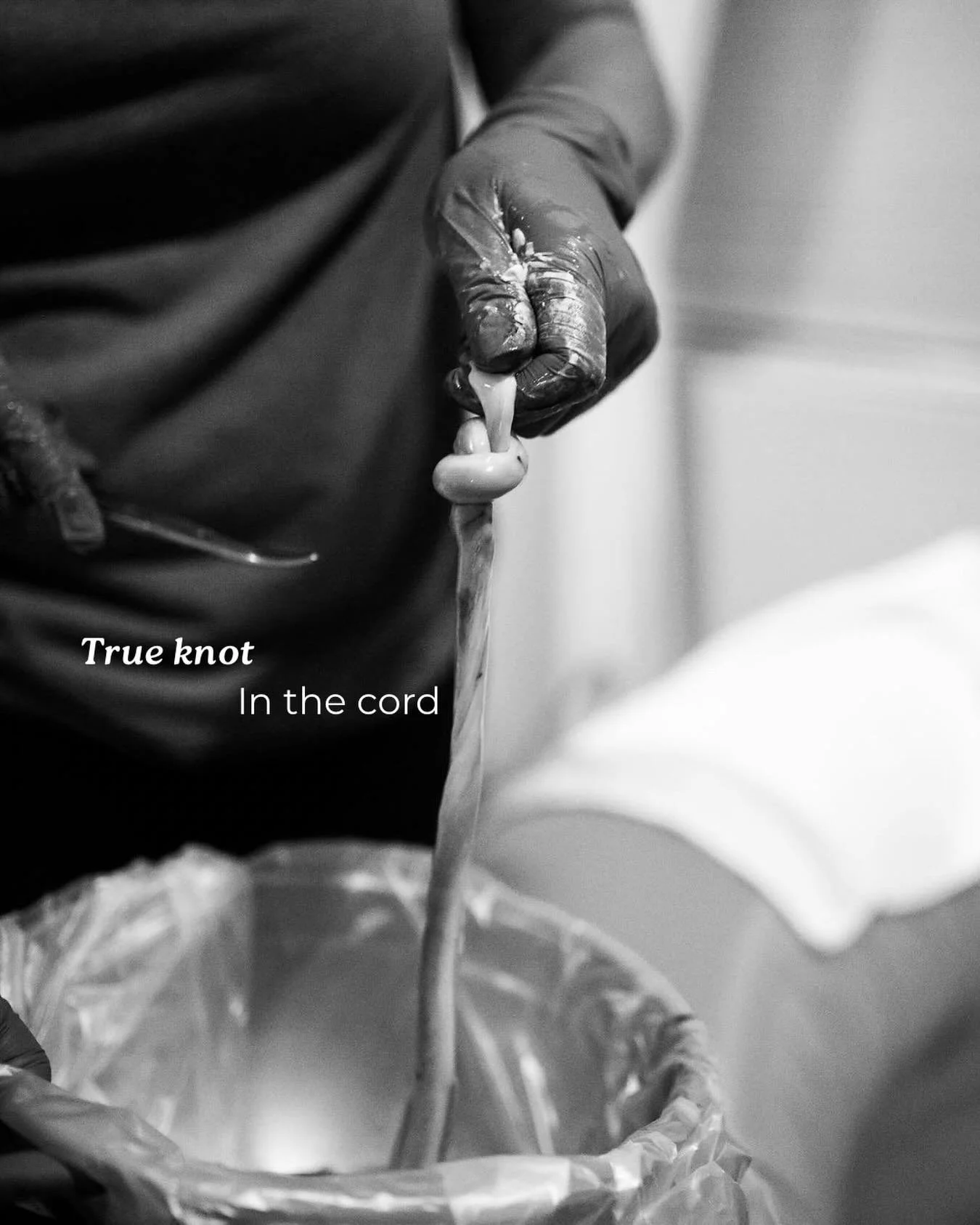 This week, I witnessed my very first true knot in the cord. A quiet reminder that not everything needs to be found or managed during pregnancy. Some things are simply held safely until they reveal themselves.

This mama&rsquo;s labour unfolded slowly