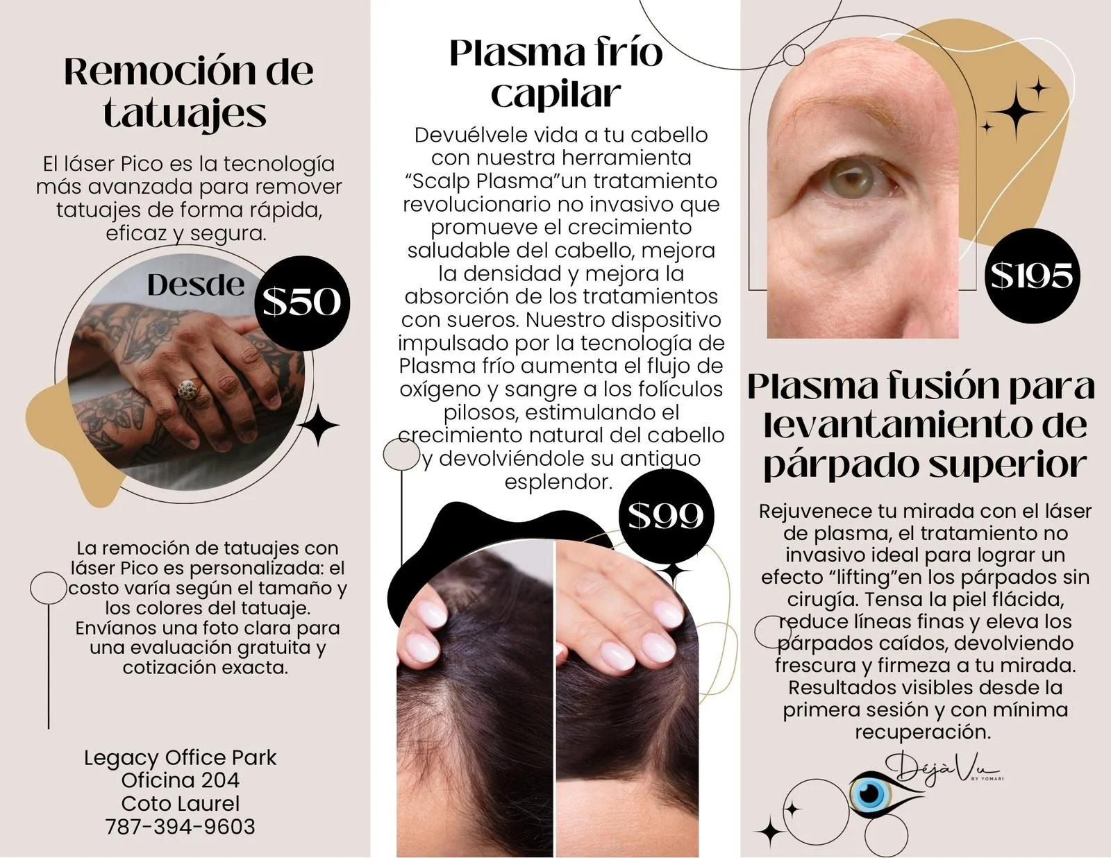 Plasma fusión para levantamiento de párpado superior