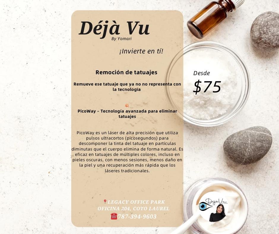 Remoción de tatuajes
