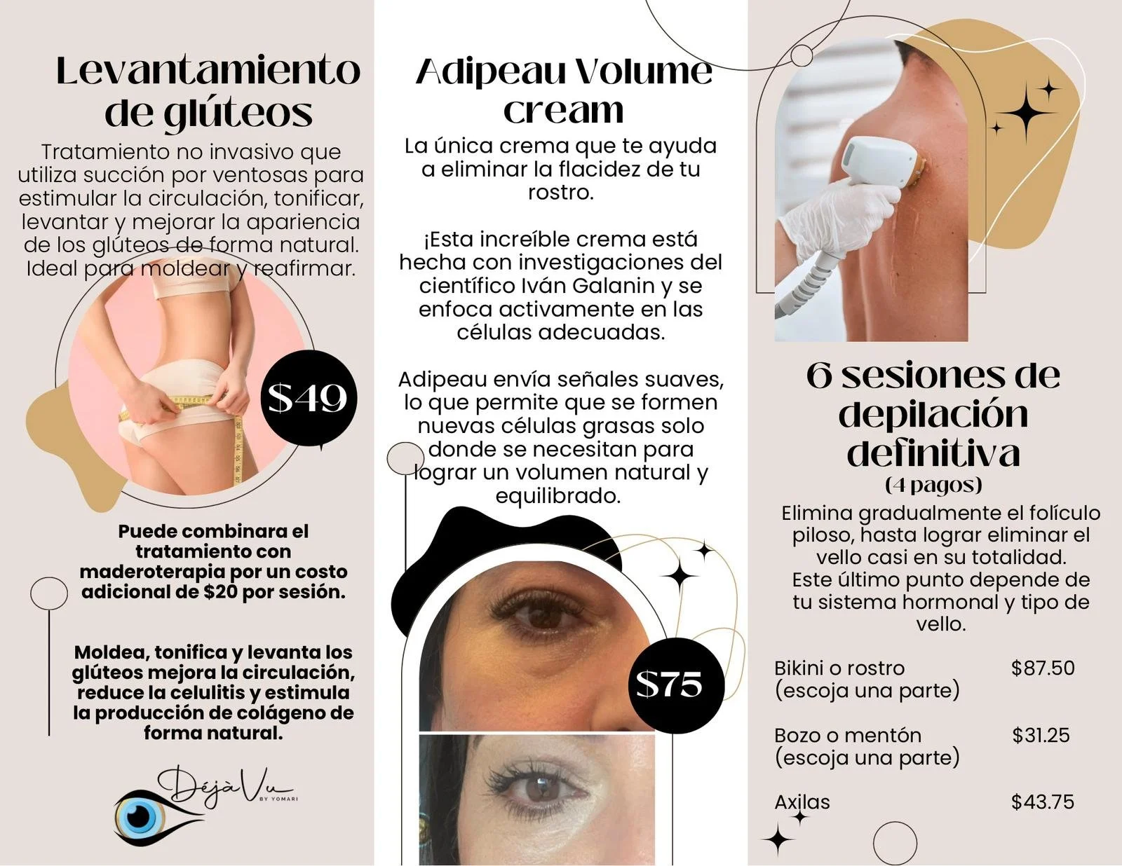 Levantamiento de glúteos