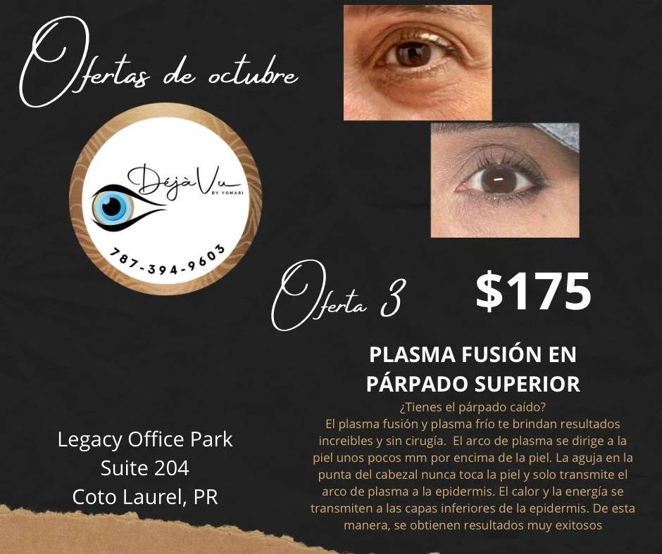 PLASMA FUSIÓN EN PÁRPADO SUPERIOR