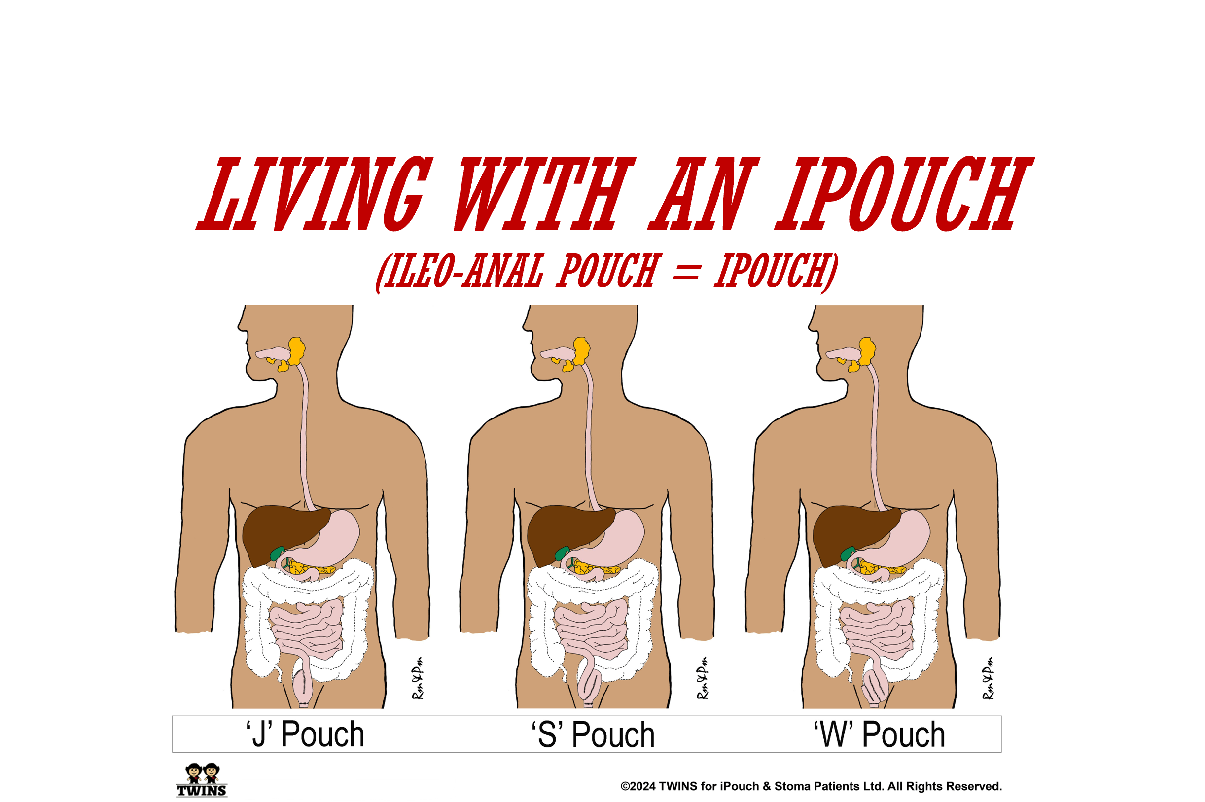 Wallpaper - Pouches.png