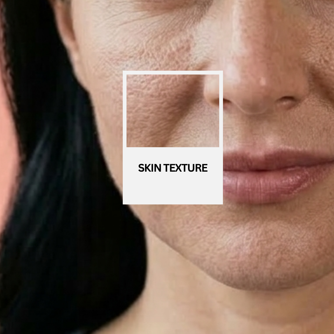 Skin texture