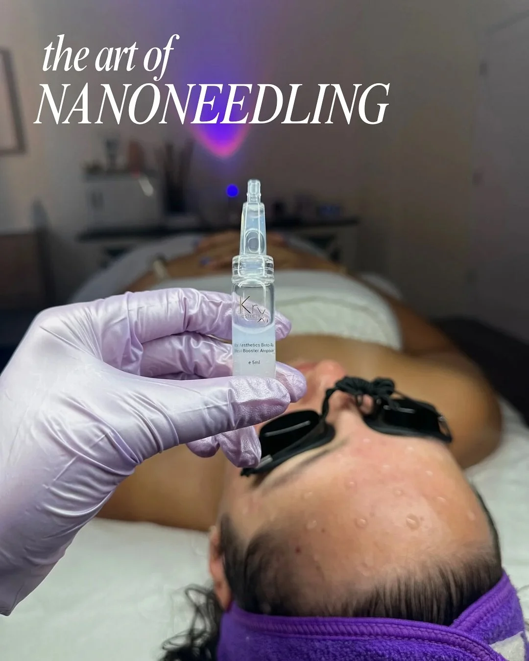 My cherry on top treatment for that glass skin glow 😍🪞✨
Nanoneedling uses ultra fine stainless steel tips to create microscopic channels on the surface of the skin. These channels don’t go deep enough to cause pain or bleeding, but they do s