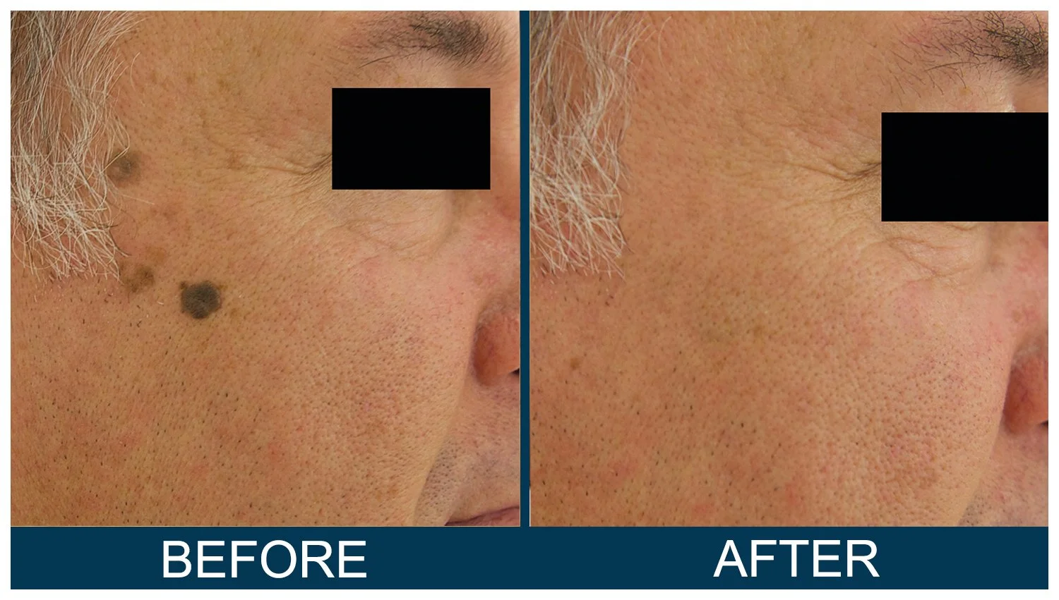 Hawkes.Bay.Laser.Skin.Cosmetic.Clincs.6.jpg