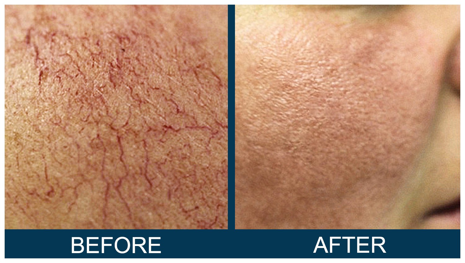 Hawkes.Bay.Laser.Skin.Cosmetic.Clincs.1.jpg