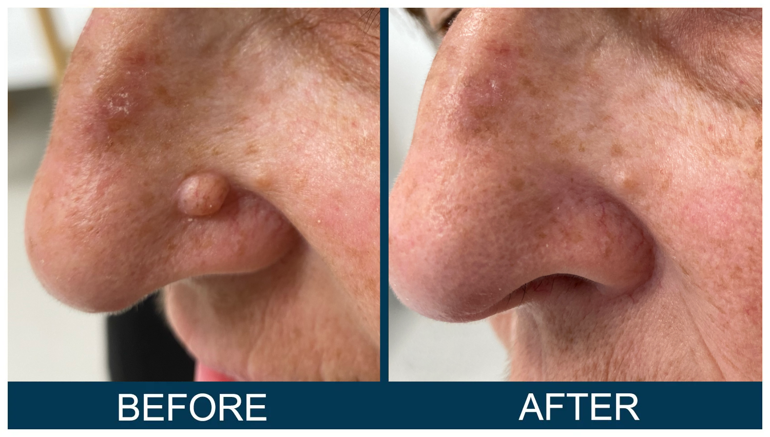 Hawkes.Bay.Laser.Skin.Cosmetic.Clincs.11.webp