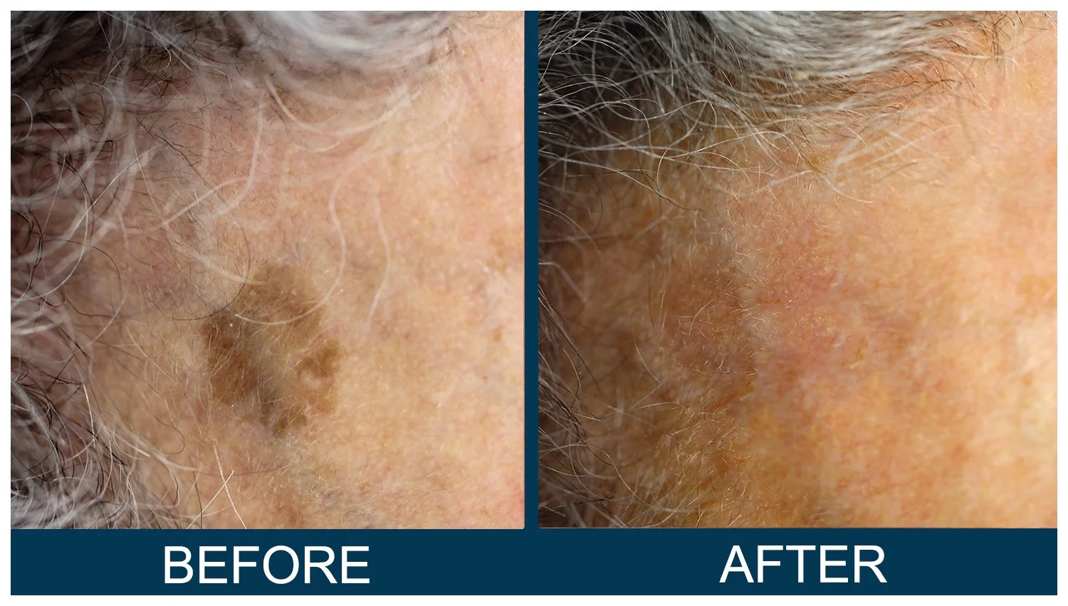 Hawkes.Bay.Laser.Skin.Cosmetic.Clincs.4.jpg