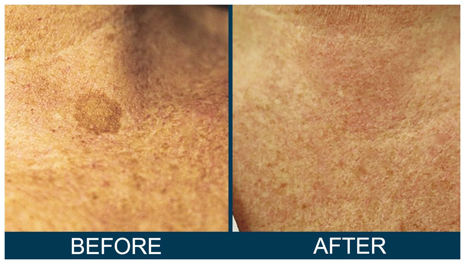 Hawkes.Bay.Laser.Skin.Cosmetic.Clincs.5.jpg