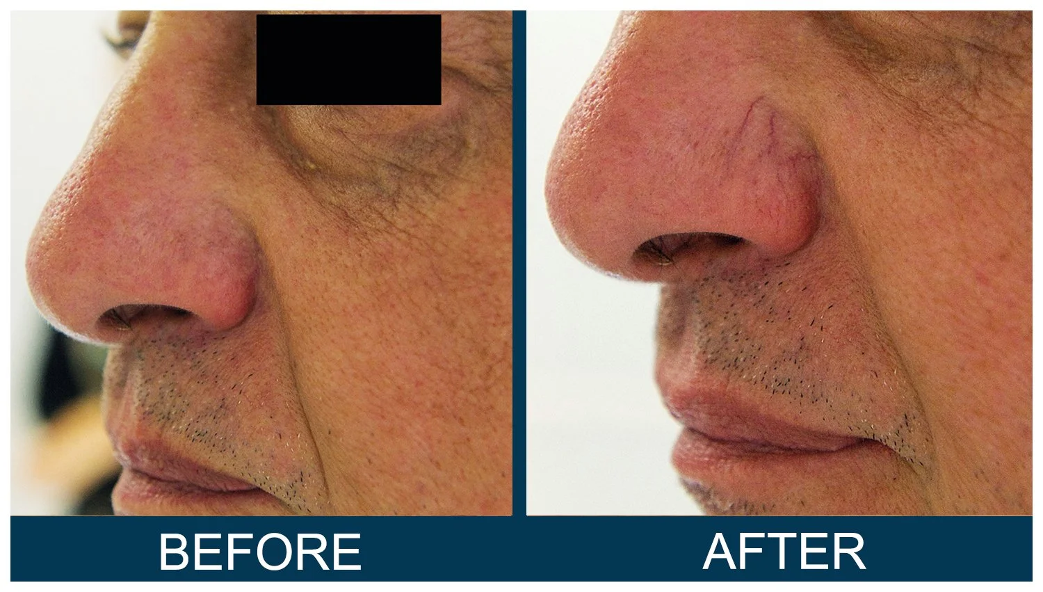 Hawkes.Bay.Laser.Skin.Cosmetic.Clincs.2.jpg