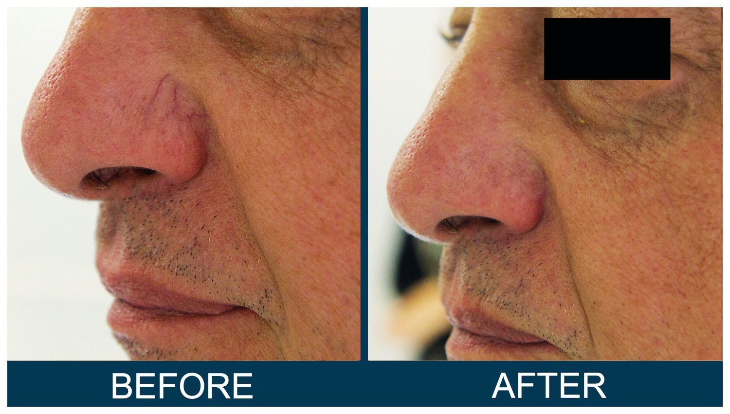 Hawkes.Bay.Laser.Skin.Cosmetic.Clincs.2.webp