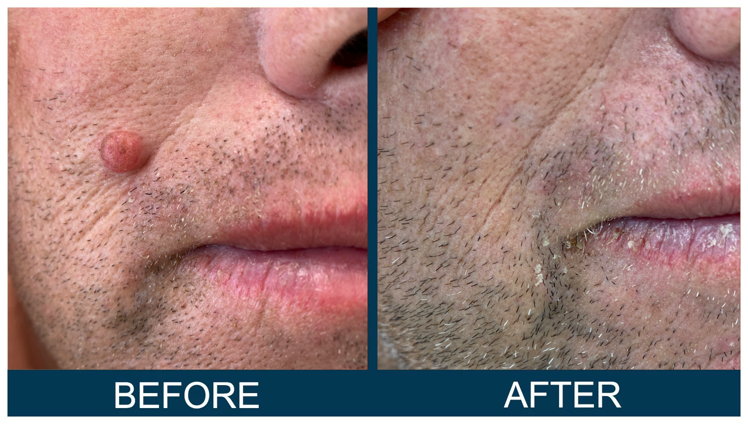 Hawkes.Bay.Laser.Skin.Cosmetic.Clincs.10.webp