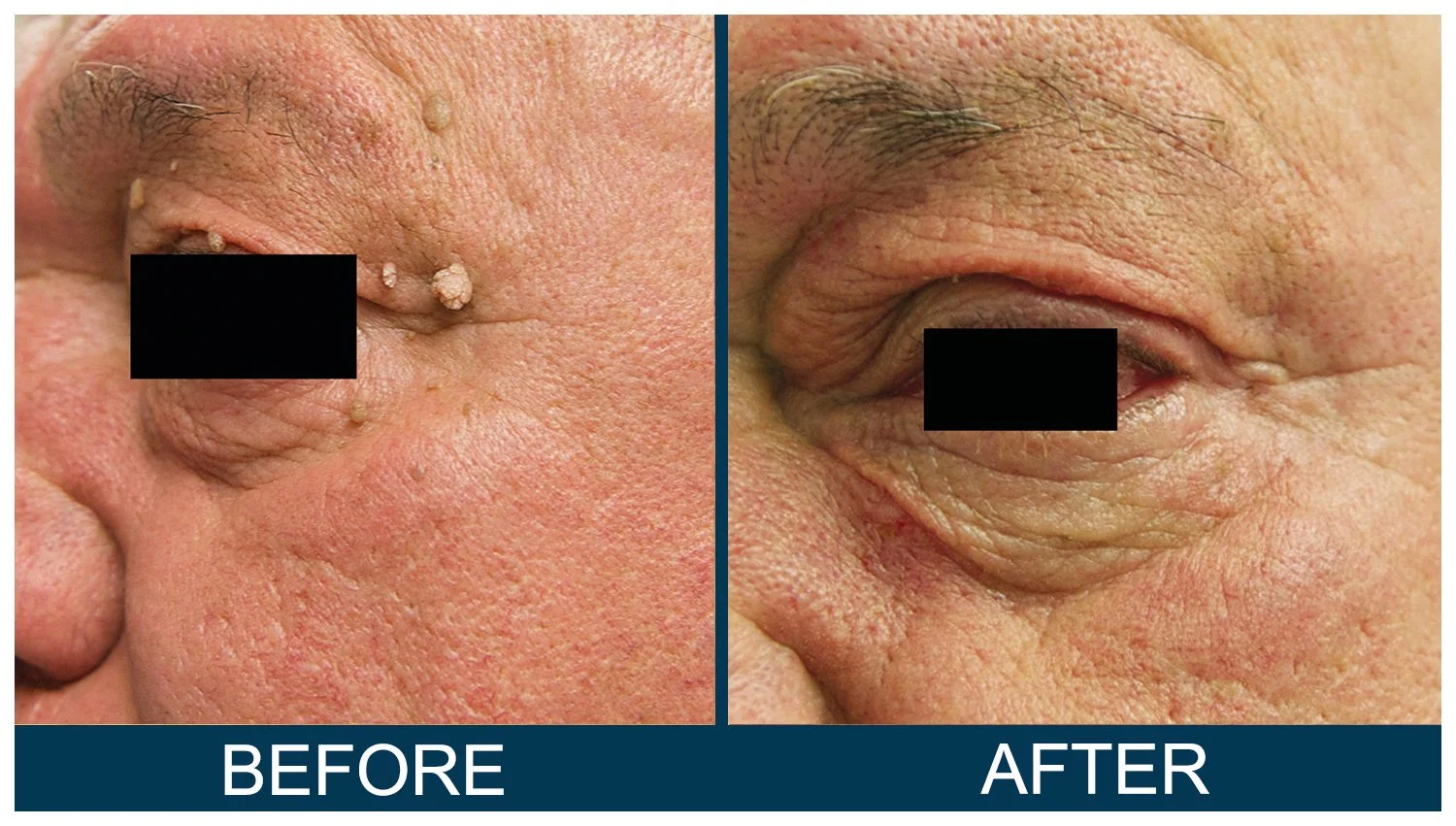 Hawkes.Bay.Laser.Skin.Cosmetic.Clincs.7.jpg