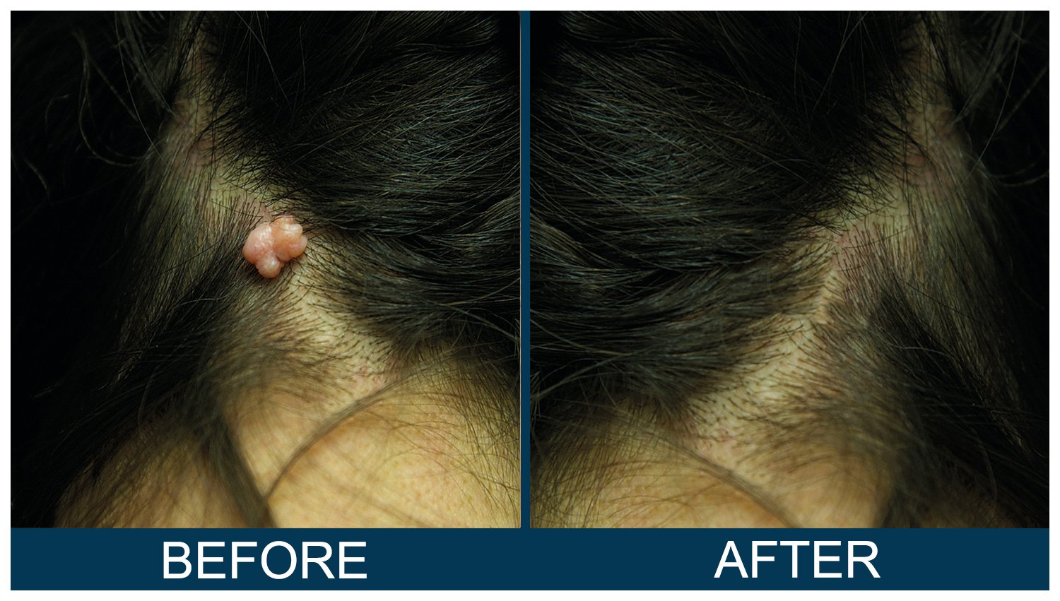 Hawkes.Bay.Laser.Skin.Cosmetic.Clincs.9.jpg