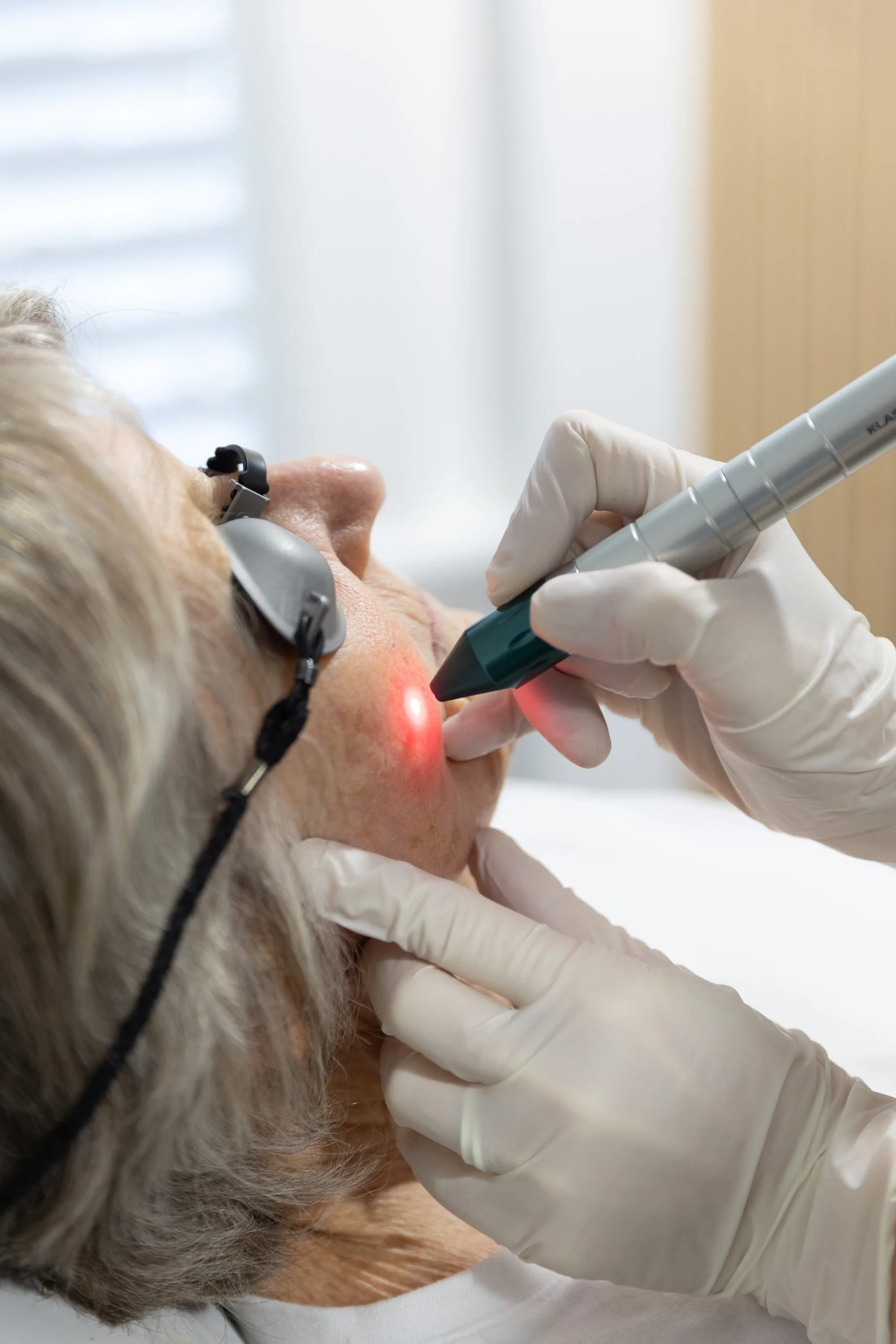 cosmetic laser skin treatments in napier hawke's bay, by a doctor