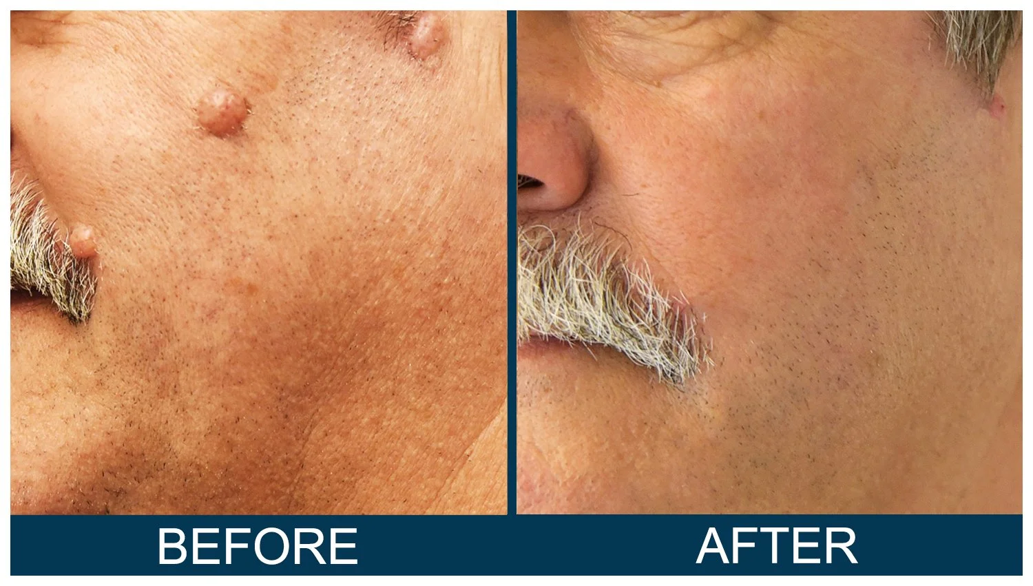Hawkes.Bay.Laser.Skin.Cosmetic.Clincs.8.jpg