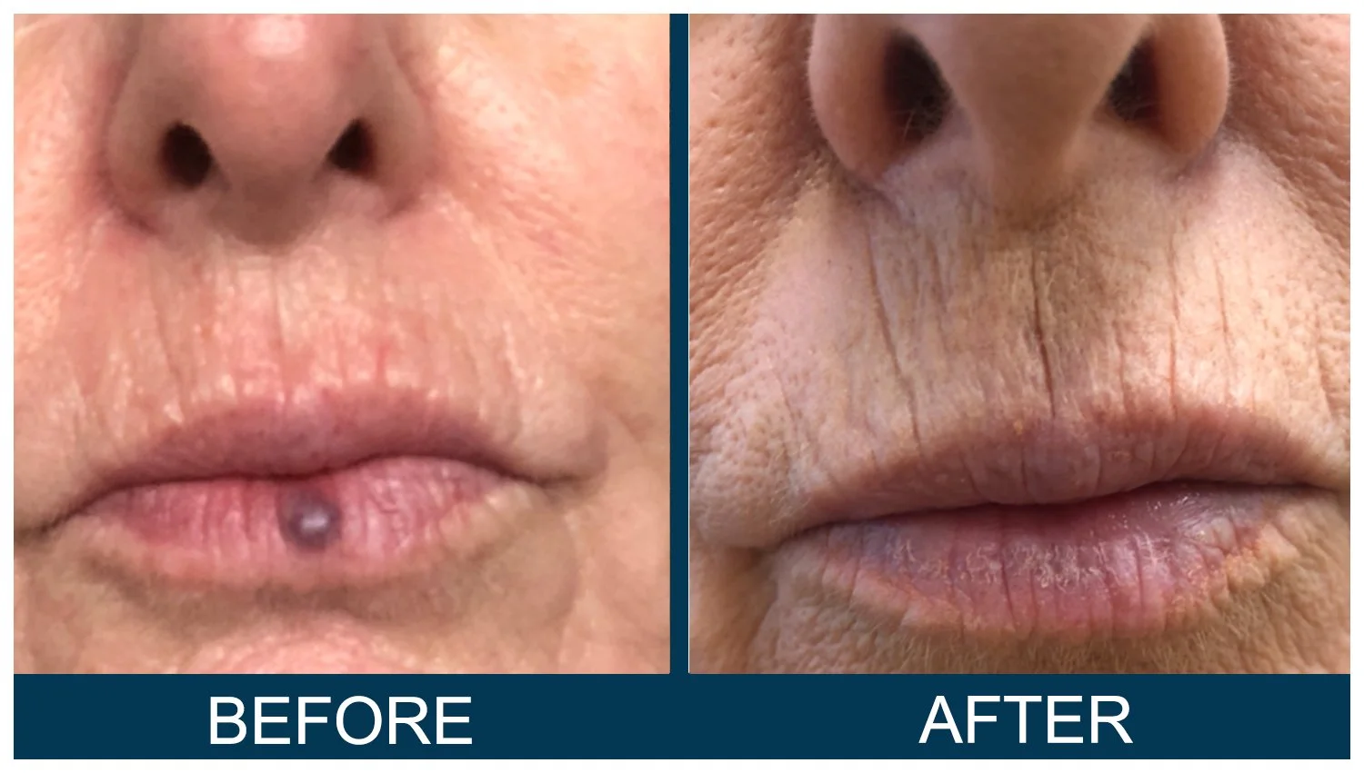 Hawkes.Bay.Laser.Skin.Cosmetic.Clincs.3.jpg