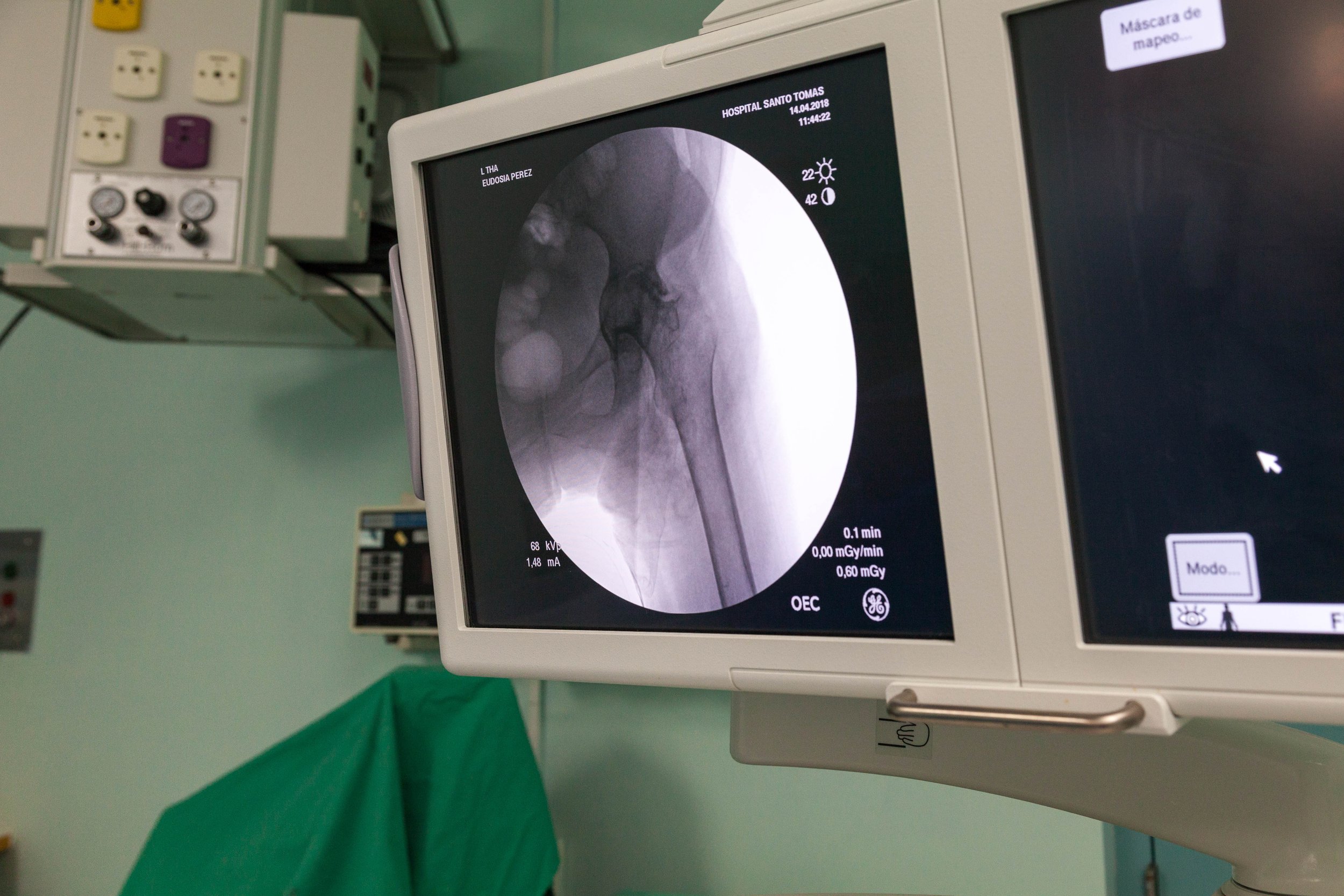 Operation Walk Virginia Joint Replacement Mission Trip Panama 2018