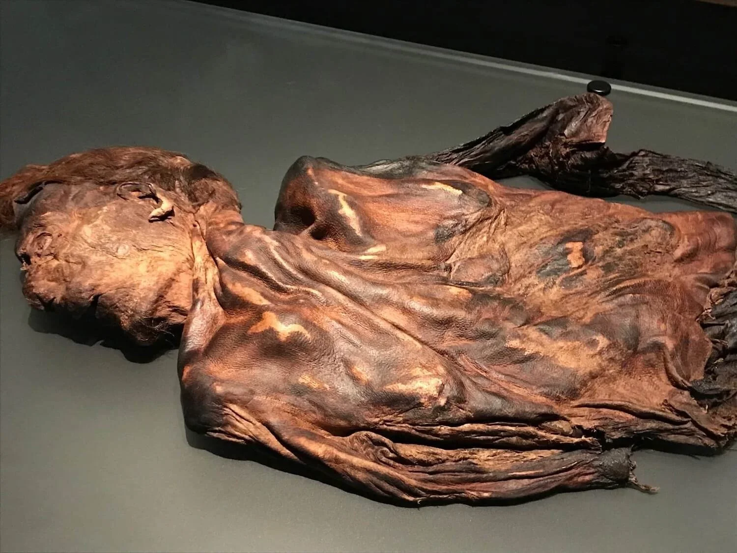 torso and head of an irish bog body sitting on an examination table