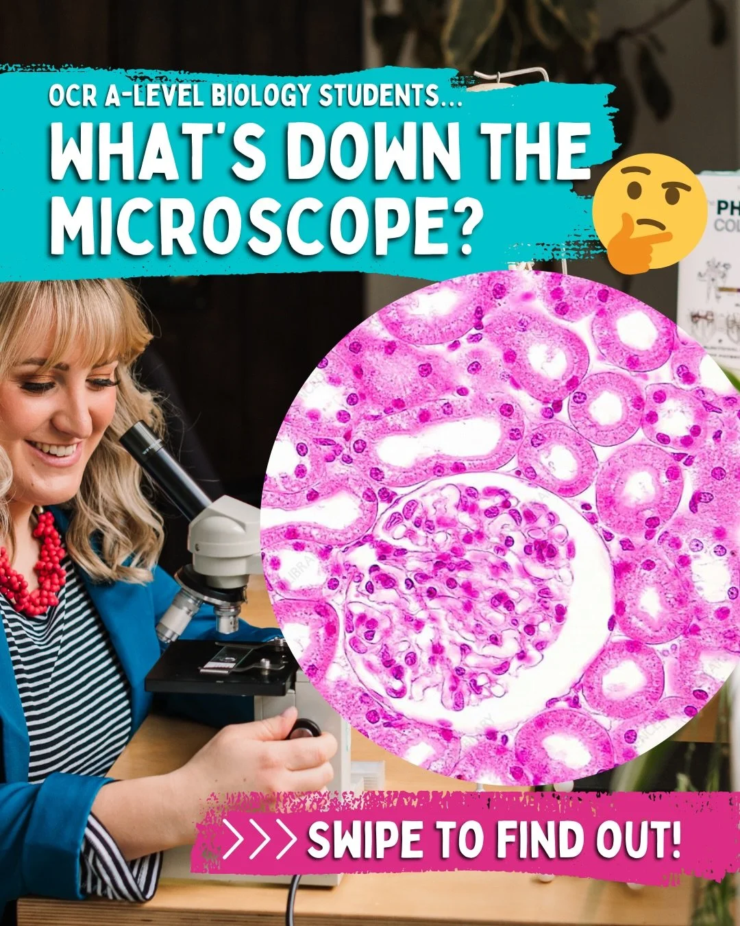 What&rsquo;s down my microscope today?! 🔬 

You&rsquo;ll find this in one of the main excretory organs of the body&hellip; The song is a bit of a clue! 🕵️&zwj;♀️ 

Swipe to see if you got it right ➡️ 
(And save to test yourself again next week if y