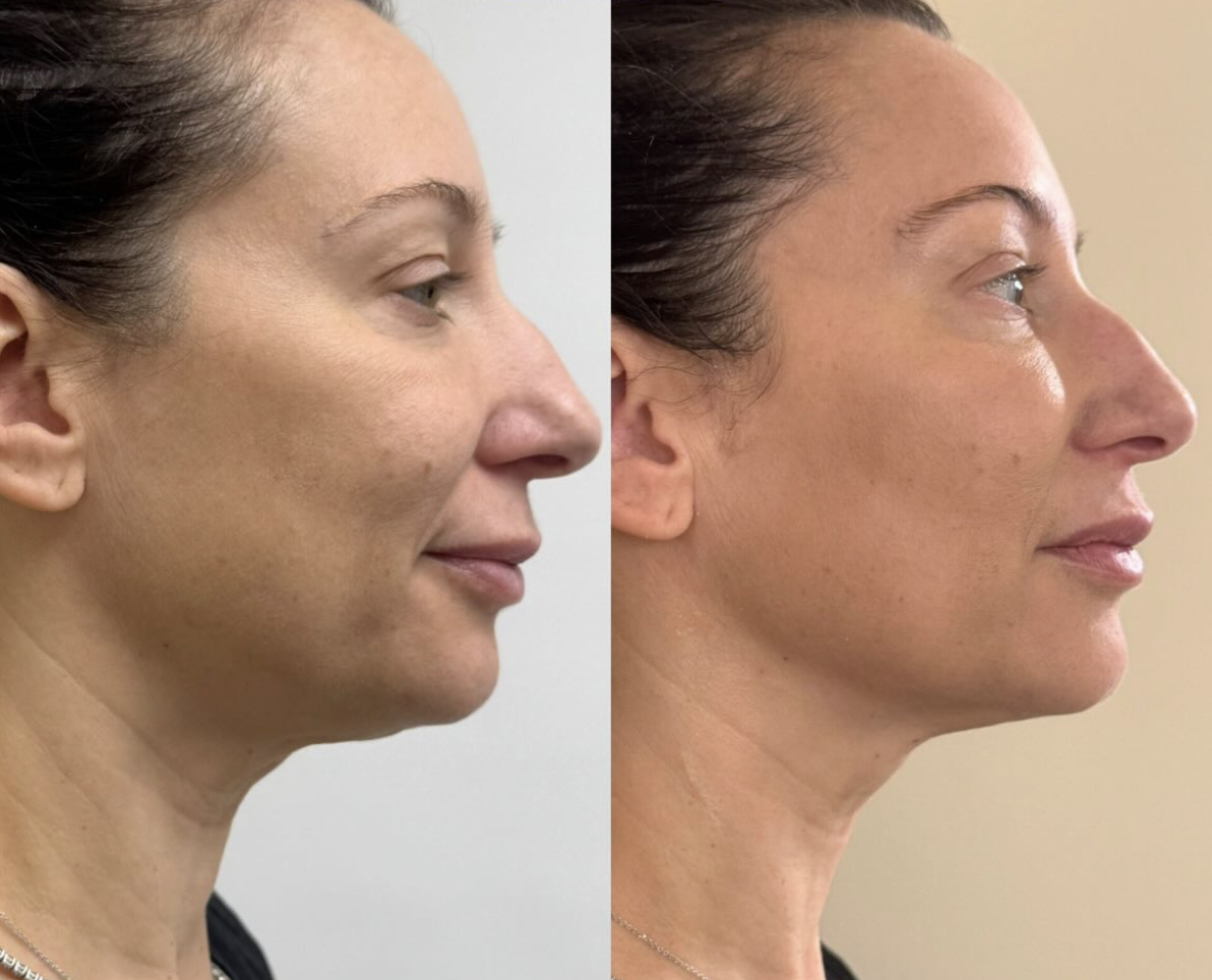 Screenshot 2026-04-01 at 10.41.45 PM.png