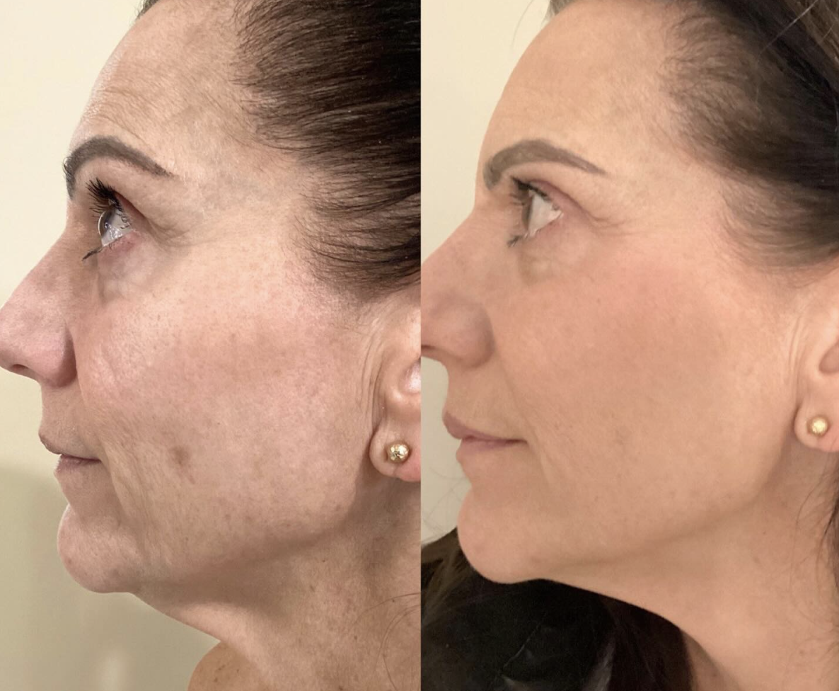 Screenshot 2026-04-01 at 10.42.36 PM.png