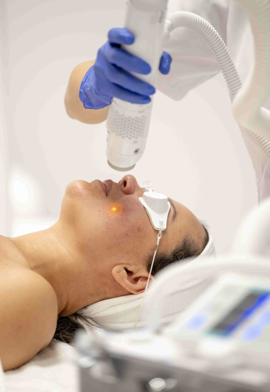 A woman lying on a medical bed undergoing a laser skin treatment on her face, with a healthcare professional using a handheld device. She is wearing protective eye goggles.