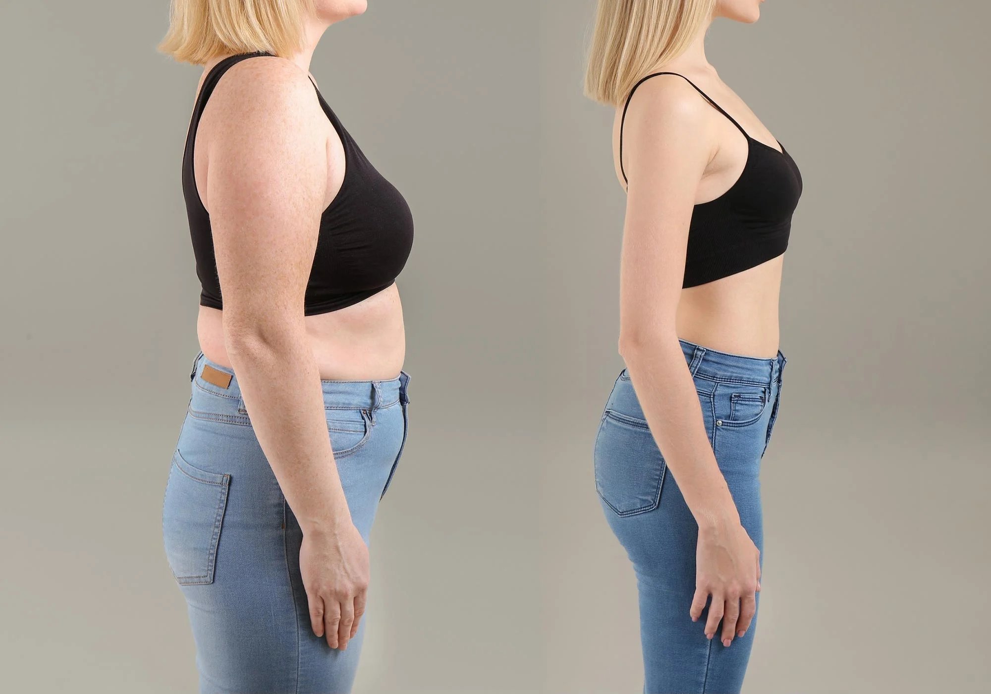 Weight-Loss-Concept-Before-and-After.jpeg