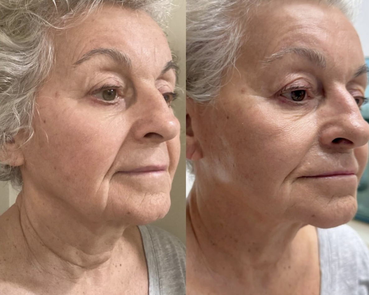 Screenshot 2026-04-01 at 10.31.52 PM.png