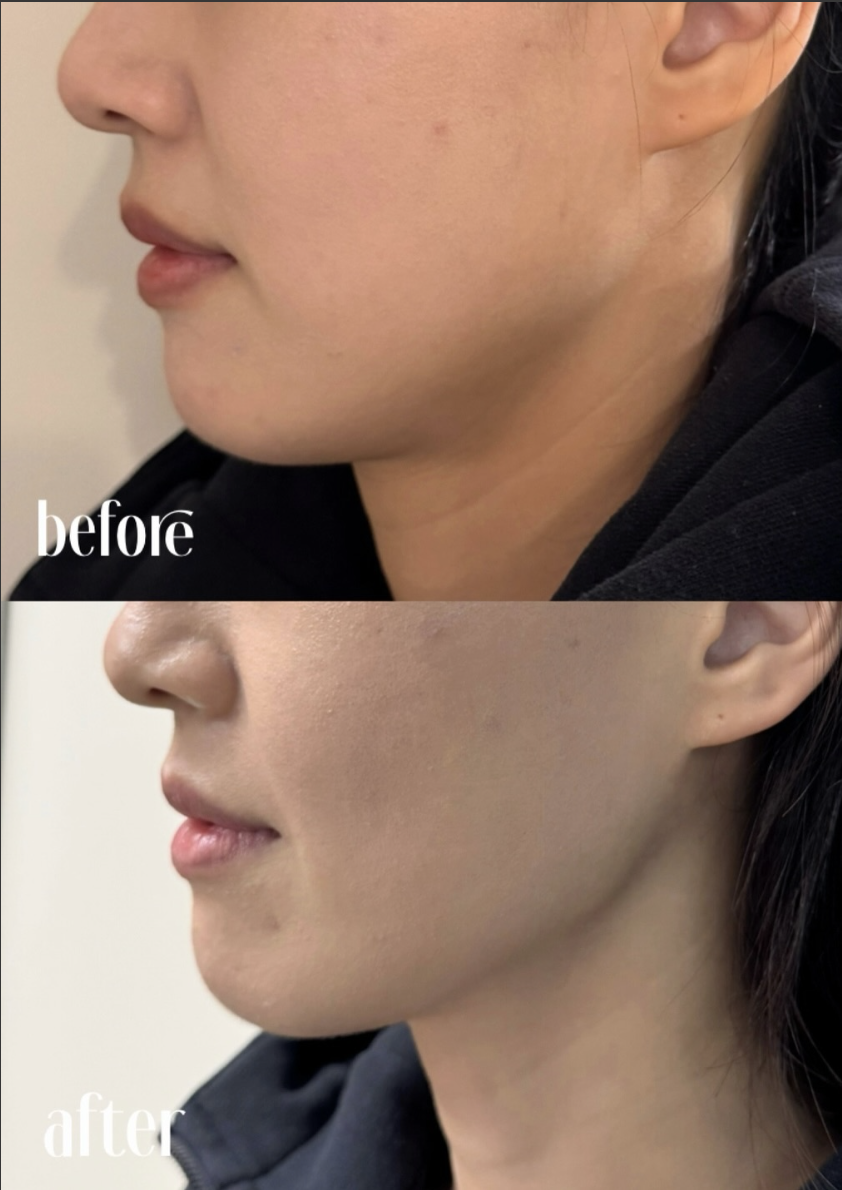 Screenshot 2026-04-01 at 10.43.20 PM.png