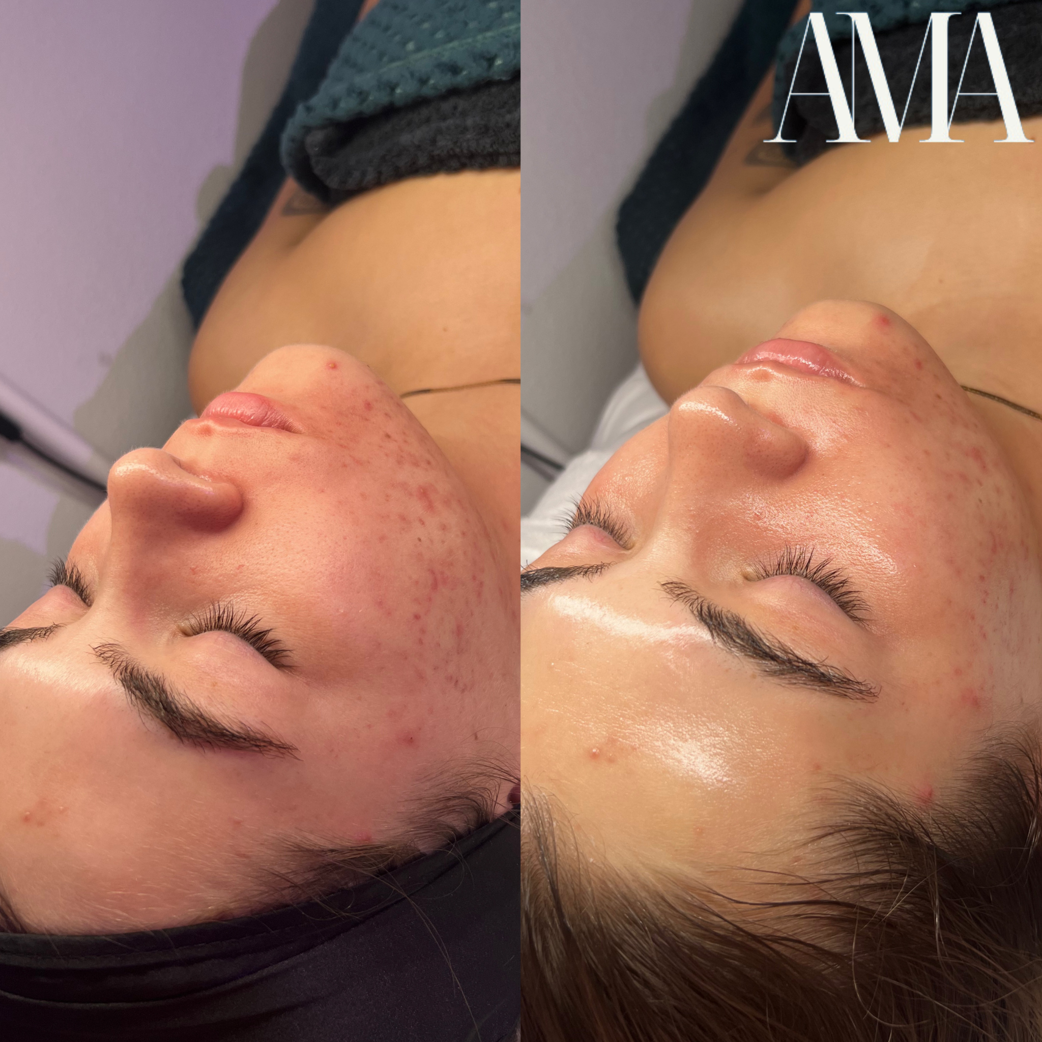 Untitled design 2.png.PNG