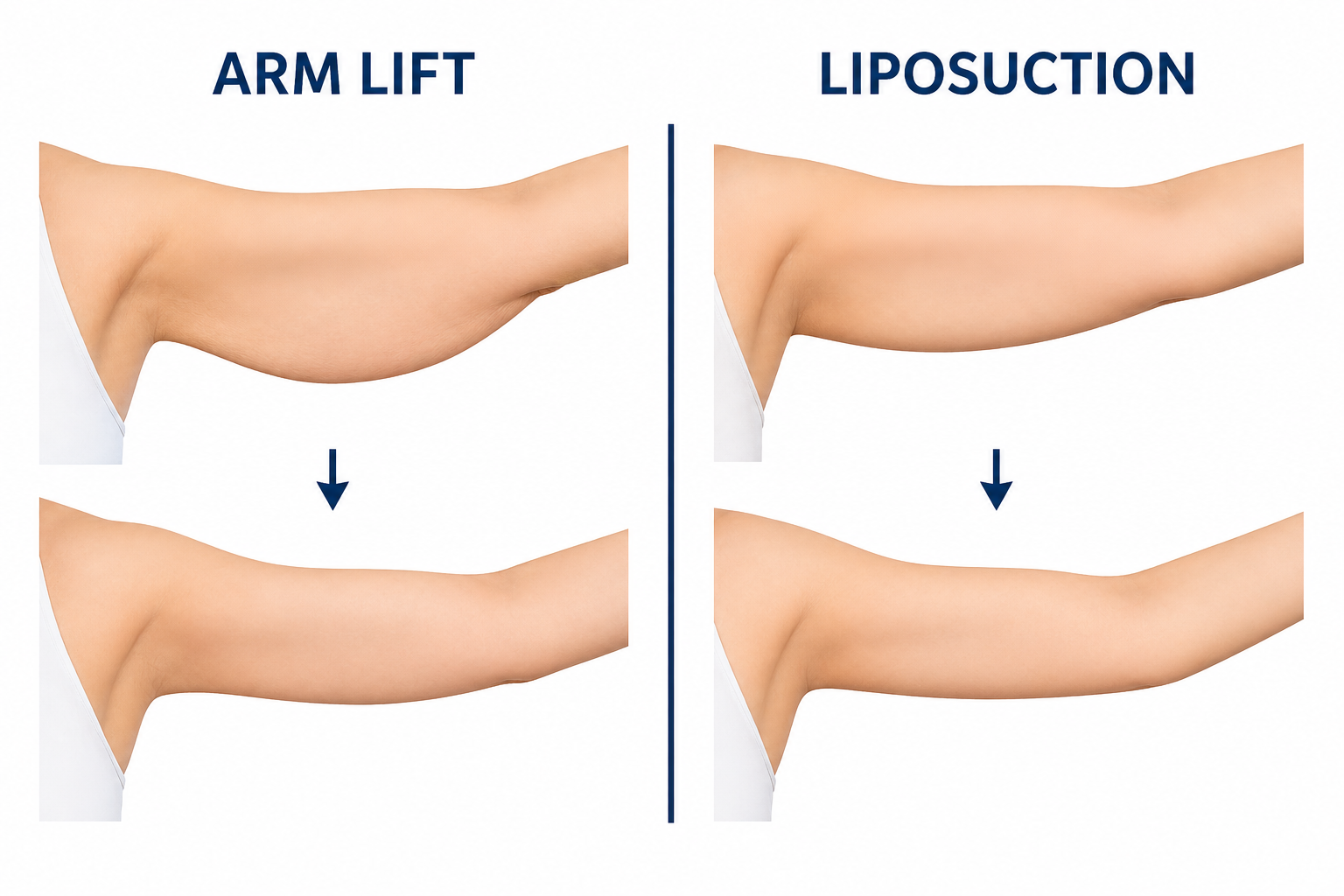 Arm Lift vs Liposuction: The One Question That Decides It</span>