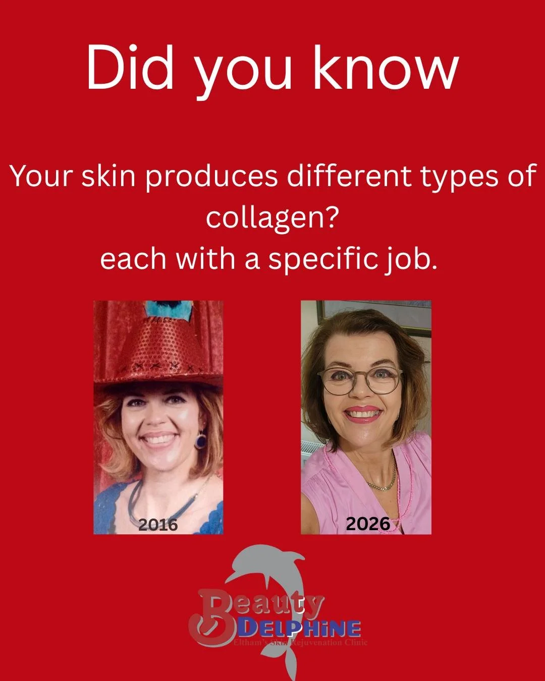 ✨Your skin produces different types of collagen, each with a specific job. 

*Type 1 gives the skin structure and firmness
*Type 2 provides flexibility and resilience
*Type 3 forms the base of the basement membrane, the skin's support scaffold

🌸Hea