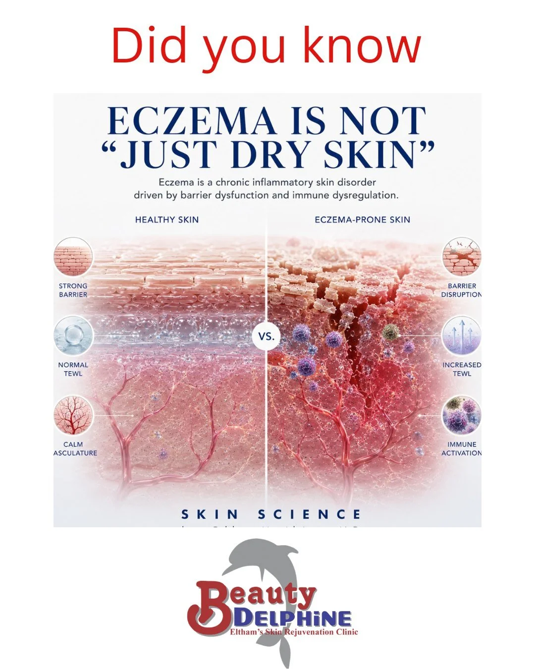 🎯Eczema is more than just &ldquo;dry skin.&rdquo; (atopic dermatitis)

💥It is a biologic barrier disorder characterised by chronic inflammation, immune dysregulation, and structural damage to the skin barrier itself. Healthy skin acts like a sealed