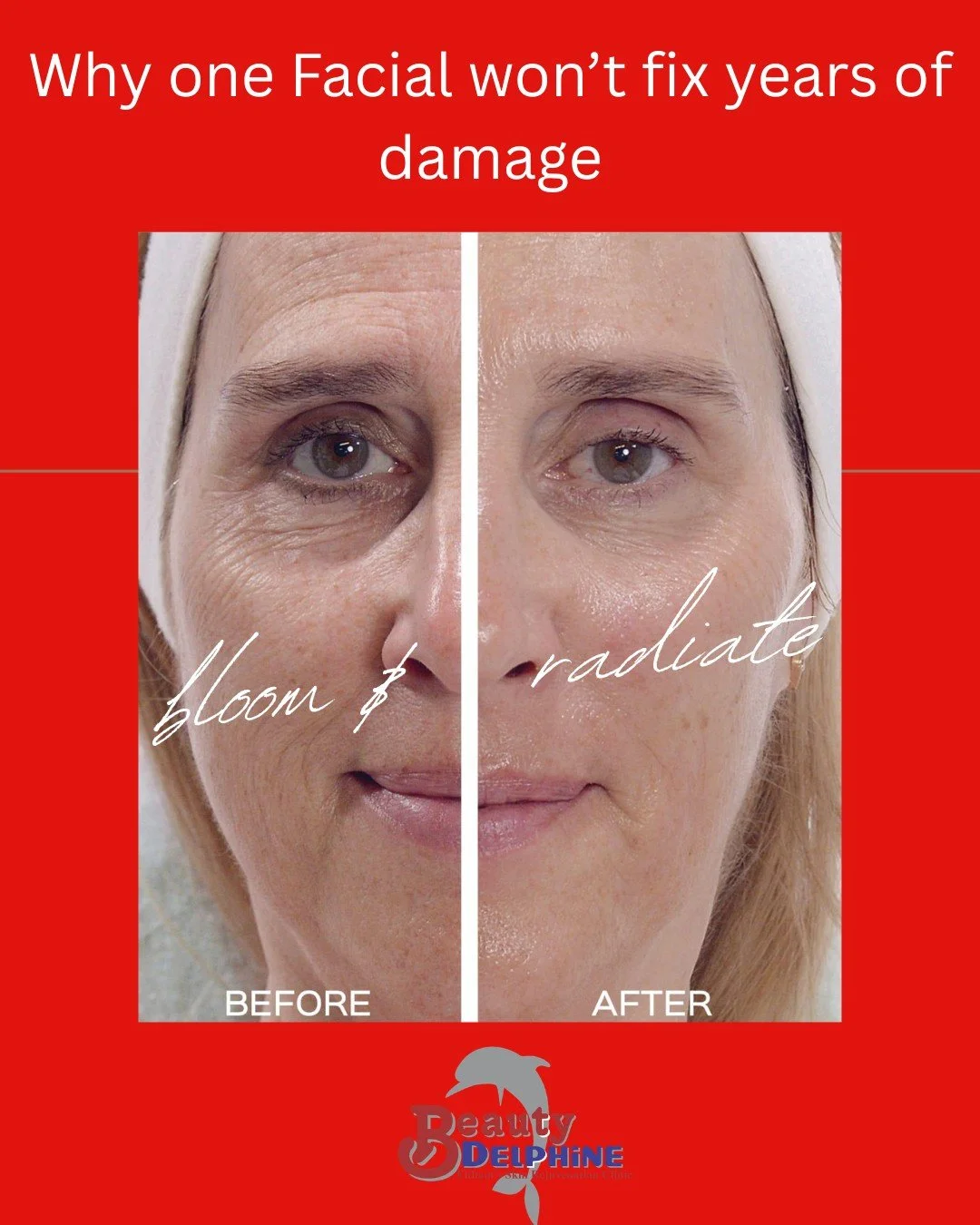 Healthy skin is a long term investment, not a one-time appointment. 
One facial can certainly give you a glow ✨, but real skin correction takes consistency. ✨ Skin issues such as pigmentation, acne, uneven texture, redness, and signs of aging often d