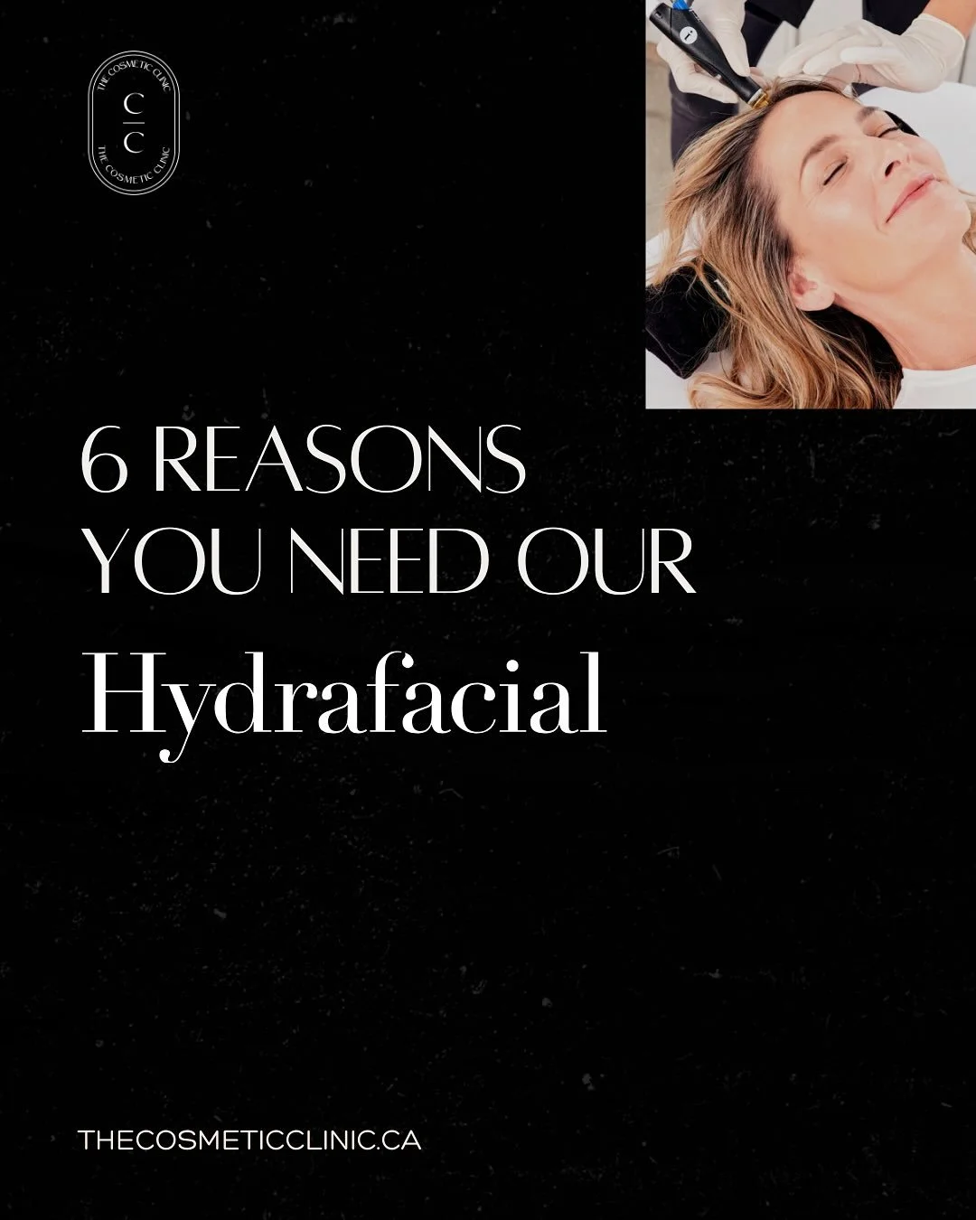 Discover why our HydraFacial is the glow-up your skin has been waiting for. ✨ 

 From a detailed consultation and custom serums to lymphatic drainage, LED Therapy, and dermaplaning - your skin gets everything it needs in one luxurious treatment. 

 B