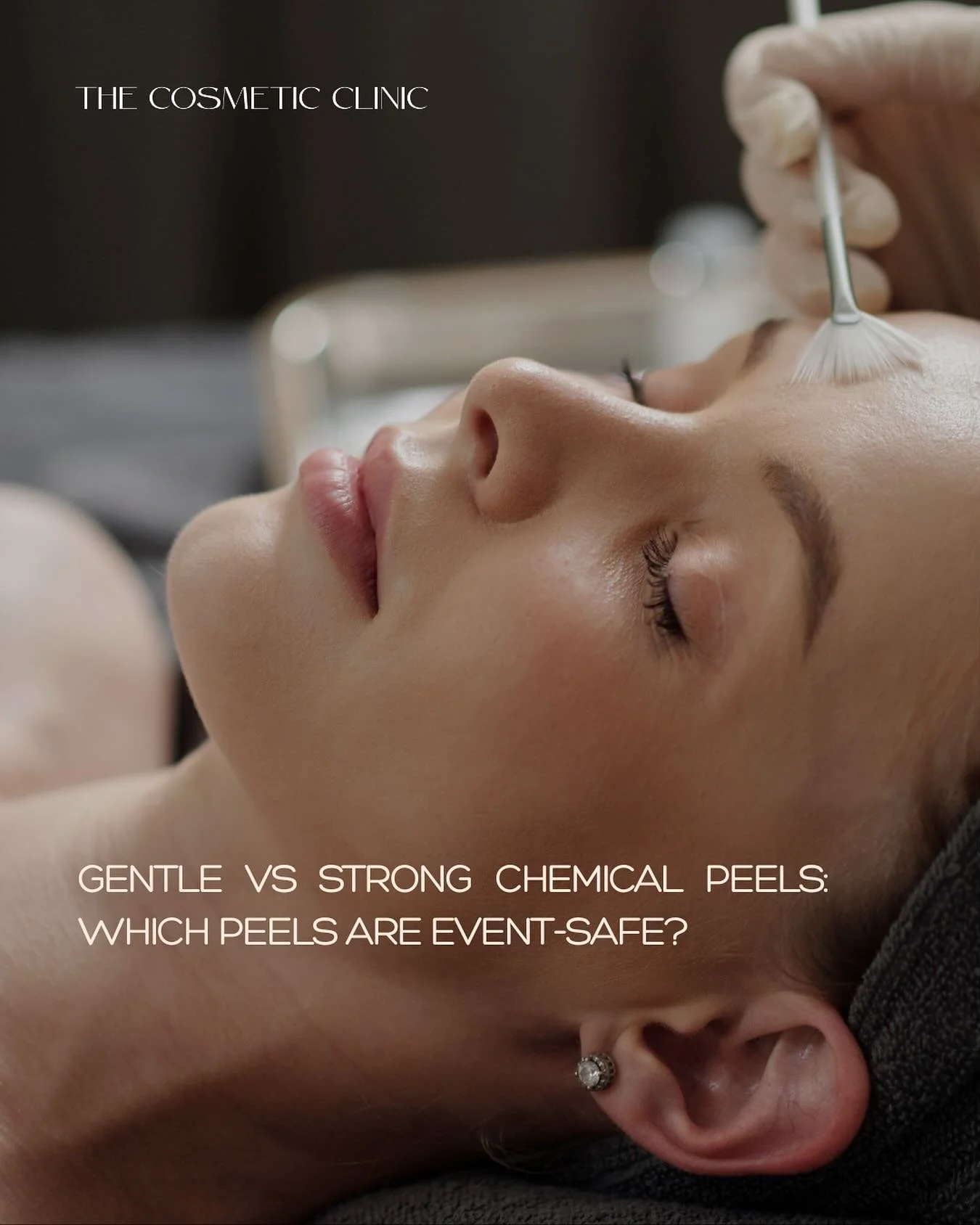 At The Cosmetic Clinic, every Chemical Peels are is designed with a different purpose, depth, and skin concern in mind.

 Chemical peels vary in strength, and how deeply they exfoliate. 
 Some peels gentle polish the surface for an instant glow, whil