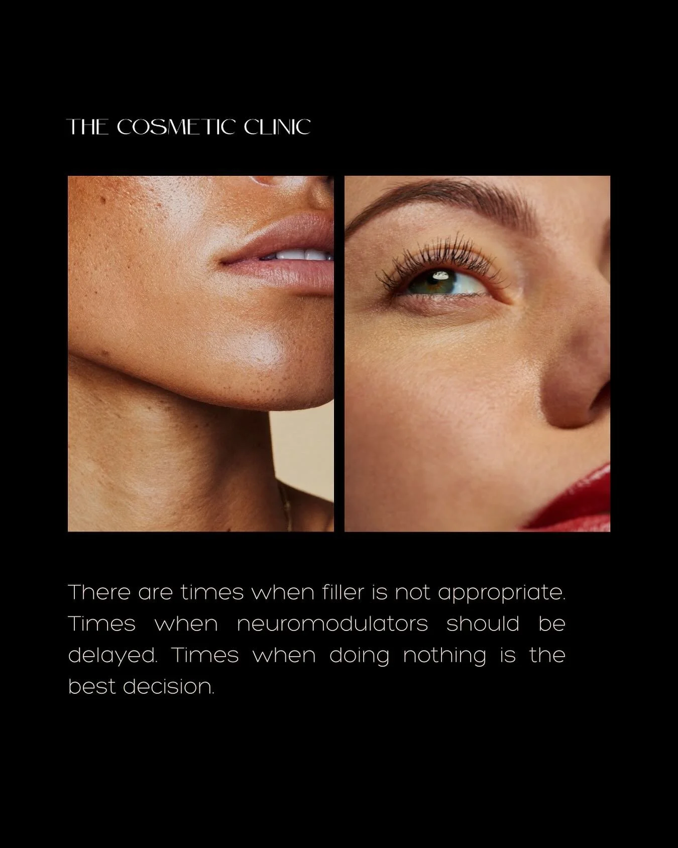 Good care includes knowing when not to treat. 

 There are times when filler is not appropriate. Times when neuromodulators should be delayed. Times when doing noting is the best decision. 

 Those choices protect facial balance and long-term outcome