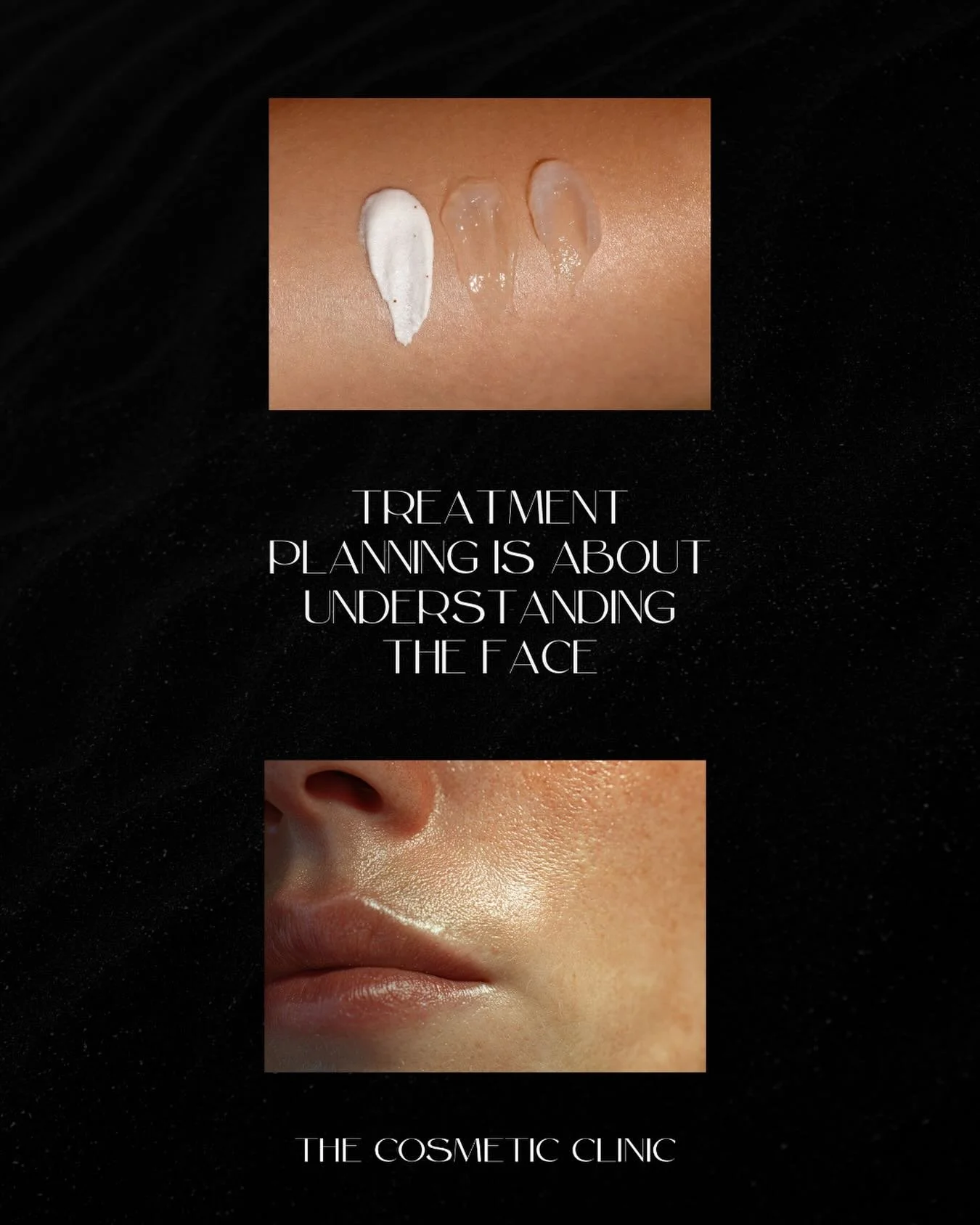 Treatment planning is not about choosing treatments. It is about understanding the face.

We assess skin quality, movement, structure, and how all layers of tissue interact. From there, we determine where treatment is needed, when it is appropriate, 