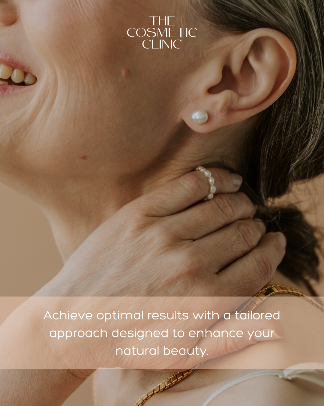 What Is a CO₂ Micropeel?